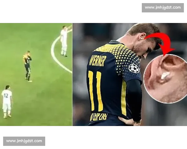 科隆主帅证实许伯斯膝伤危急 球员自知情况不妙